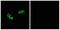 Olfactory Receptor Family 56 Subfamily A Member 3 antibody, A17562, Boster Biological Technology, Immunohistochemistry paraffin image 