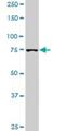 Phosphoinositide-3-Kinase Regulatory Subunit 1 antibody, H00005295-M03, Novus Biologicals, Western Blot image 