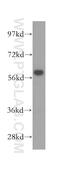 Chaperonin Containing TCP1 Subunit 7 antibody, 15994-1-AP, Proteintech Group, Western Blot image 