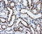 SATB Homeobox 1 antibody, LS-C114686, Lifespan Biosciences, Immunohistochemistry paraffin image 