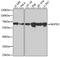 Nucleoporin 62 antibody, A03950, Boster Biological Technology, Western Blot image 