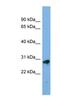 Kallikrein Related Peptidase 13 antibody, NBP1-56348, Novus Biologicals, Western Blot image 