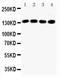 Insulin Receptor Substrate 1 antibody, PA2269, Boster Biological Technology, Western Blot image 