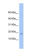 LOC285033 antibody, orb325924, Biorbyt, Western Blot image 