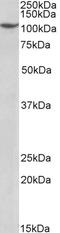 Pre-MRNA Processing Factor 6 antibody, STJ72063, St John