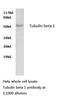 Tubulin Beta 1 Class VI antibody, LS-C175849, Lifespan Biosciences, Western Blot image 