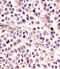 Interleukin-24 antibody, M03793, Boster Biological Technology, Immunohistochemistry paraffin image 