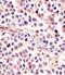 Interleukin 24 antibody, M03793, Boster Biological Technology, Immunohistochemistry paraffin image 