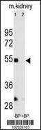 Matrix Metallopeptidase 12 antibody, 62-169, ProSci, Western Blot image 