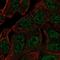 Ankyrin Repeat Domain 65 antibody, PA5-64240, Invitrogen Antibodies, Immunofluorescence image 