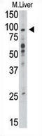 Toll-like receptor 6 antibody, AP11536PU-N, Origene, Western Blot image 