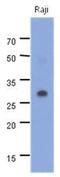 MYD88 Innate Immune Signal Transduction Adaptor antibody, GTX53746, GeneTex, Western Blot image 
