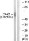 Mitogen-Activated Protein Kinase Kinase Kinase 7 antibody, TA326164, Origene, Western Blot image 