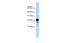 Chorionic Somatomammotropin Hormone Like 1 antibody, 25-733, ProSci, Enzyme Linked Immunosorbent Assay image 