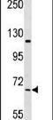 NIMA Related Kinase 11 antibody, PA5-15334, Invitrogen Antibodies, Western Blot image 