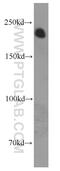 Neurofilament Heavy antibody, 60331-1-Ig, Proteintech Group, Western Blot image 