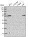 Carbohydrate Sulfotransferase 3 antibody, PA5-65472, Invitrogen Antibodies, Western Blot image 