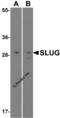 Snail Family Transcriptional Repressor 2 antibody, 3959, ProSci, Western Blot image 