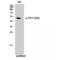 Tryptophan Hydroxylase 1 antibody, LS-C381340, Lifespan Biosciences, Western Blot image 