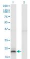 Interferon Alpha 13 antibody, H00003447-M03, Novus Biologicals, Western Blot image 