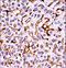 Macrophage Stimulating 1 Receptor antibody, LS-C164490, Lifespan Biosciences, Immunohistochemistry frozen image 