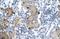 Zinc Finger MYM-Type Containing 6 antibody, NBP1-80053, Novus Biologicals, Immunohistochemistry frozen image 