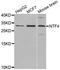 Neurotrophin 4 antibody, A3180, ABclonal Technology, Western Blot image 