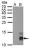 Pancreatic Polypeptide antibody, MA5-27773, Invitrogen Antibodies, Western Blot image 