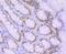 Caudal Type Homeobox 2 antibody, NBP2-66769, Novus Biologicals, Immunohistochemistry paraffin image 