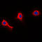 Neutrophil Cytosolic Factor 1 antibody, LS-C353699, Lifespan Biosciences, Immunofluorescence image 