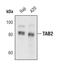 TGF-Beta Activated Kinase 1 (MAP3K7) Binding Protein 2 antibody, MA5-14818, Invitrogen Antibodies, Western Blot image 