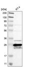 Methenyltetrahydrofolate Synthetase antibody, PA5-52509, Invitrogen Antibodies, Western Blot image 