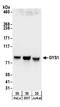 Glycogen Synthase 1 antibody, A304-239A, Bethyl Labs, Western Blot image 