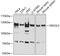 Mtr4 Exosome RNA Helicase antibody, GTX54698, GeneTex, Western Blot image 