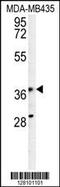 Phosphoribosyl Pyrophosphate Synthetase Associated Protein 1 antibody, 55-164, ProSci, Western Blot image 