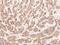 Erb-B2 Receptor Tyrosine Kinase 3 antibody, 10201-T24, Sino Biological, Immunohistochemistry paraffin image 