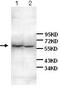 Interleukin 6 Receptor antibody, ab128008, Abcam, Western Blot image 