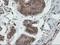 Ubiquitin Conjugating Enzyme E2 E3 antibody, NBP2-03819, Novus Biologicals, Immunohistochemistry frozen image 