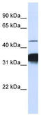 Retinoid X Receptor Alpha antibody, TA332107, Origene, Western Blot image 