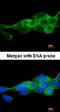 Inhibitor Of Nuclear Factor Kappa B Kinase Subunit Beta antibody, NBP1-32258, Novus Biologicals, Immunocytochemistry image 