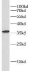 MUCEN antibody, FNab10350, FineTest, Western Blot image 