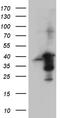 Protein Kinase AMP-Activated Non-Catalytic Subunit Beta 1 antibody, LS-C796649, Lifespan Biosciences, Western Blot image 