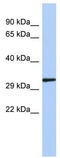 NK2 Homeobox 2 antibody, TA330256, Origene, Western Blot image 