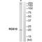 Regulator Of G Protein Signaling 10 antibody, A05197, Boster Biological Technology, Western Blot image 