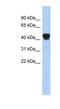 Endoplasmic Reticulum Protein 44 antibody, NBP1-56623, Novus Biologicals, Western Blot image 