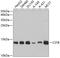 Cystatin B antibody, 19-170, ProSci, Western Blot image 