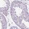 Cadherin 1 antibody, NBP1-84588, Novus Biologicals, Immunohistochemistry paraffin image 