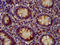 VPS52 Subunit Of GARP Complex antibody, LS-C674099, Lifespan Biosciences, Immunohistochemistry paraffin image 
