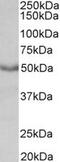 ACHR antibody, MBS420792, MyBioSource, Western Blot image 