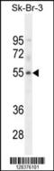 DDB1 And CUL4 Associated Factor 4 Like 1 antibody, 55-487, ProSci, Western Blot image 